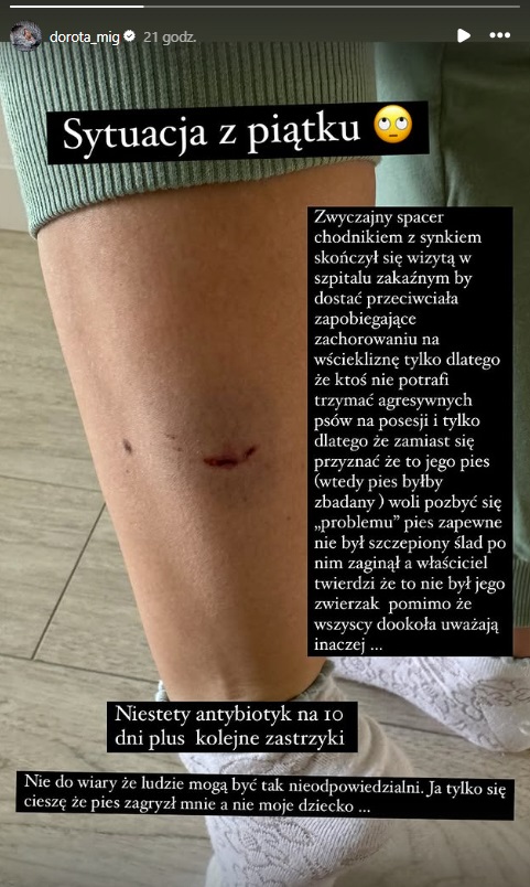 pogryzienie przez psa